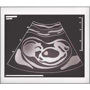 Ultrasound Baby Photo