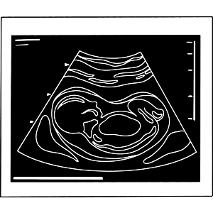 Ultrasound Baby Photo